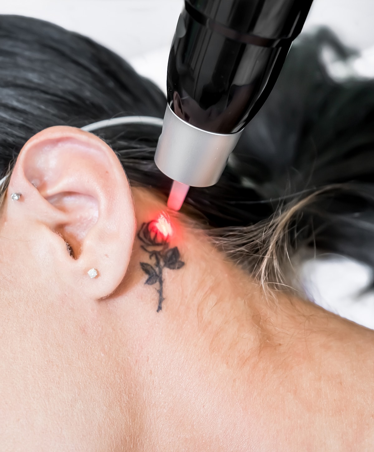 Laser tattoo removal on woman's neck.
