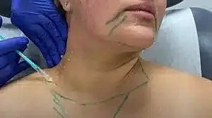 Cosmetic procedure on woman's neck and jawline.