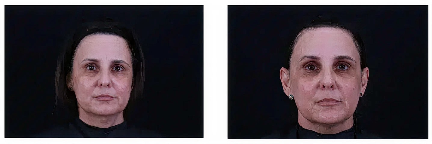 Before and after aging effects on a woman's face.