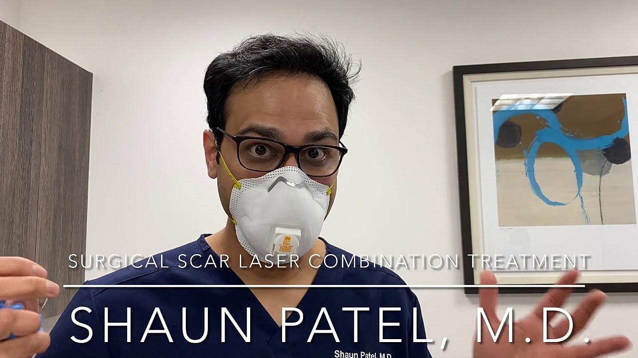 Doctor discussing surgical scar laser treatment options.