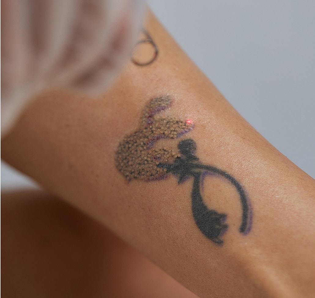 Creative tattoo design on arm.